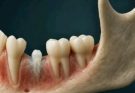 Le Japon lance le premier essai humain d’un médicament qui fait repousser les dents !